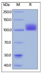 Human M-CSF R, Fc Tag on SDS-PAGE under reducing (R) condition. The gel was stained overnight with Coomassie Blue. The purity of the protein is greater than 95%.